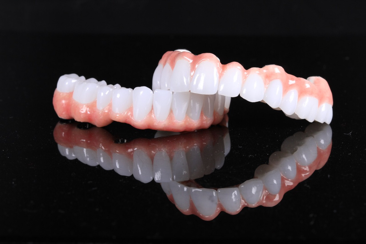 Prettau Zirconia full-arch bridge crafted in the Wyo Dental Implants lab